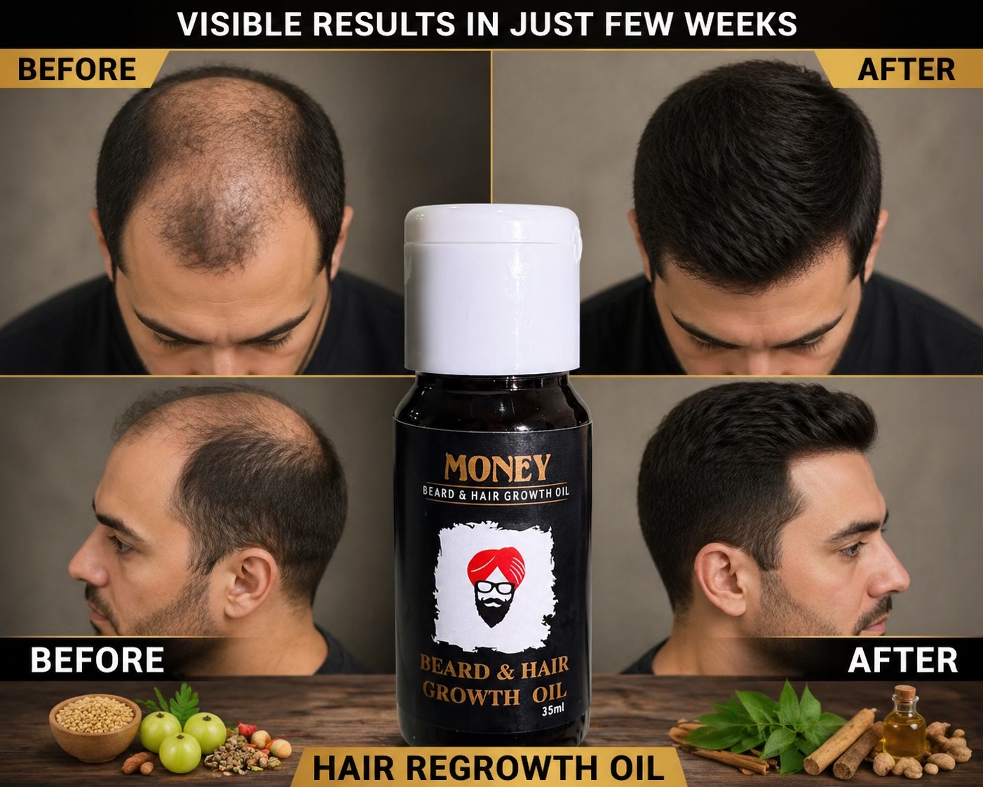 @money_beard_growthoil
