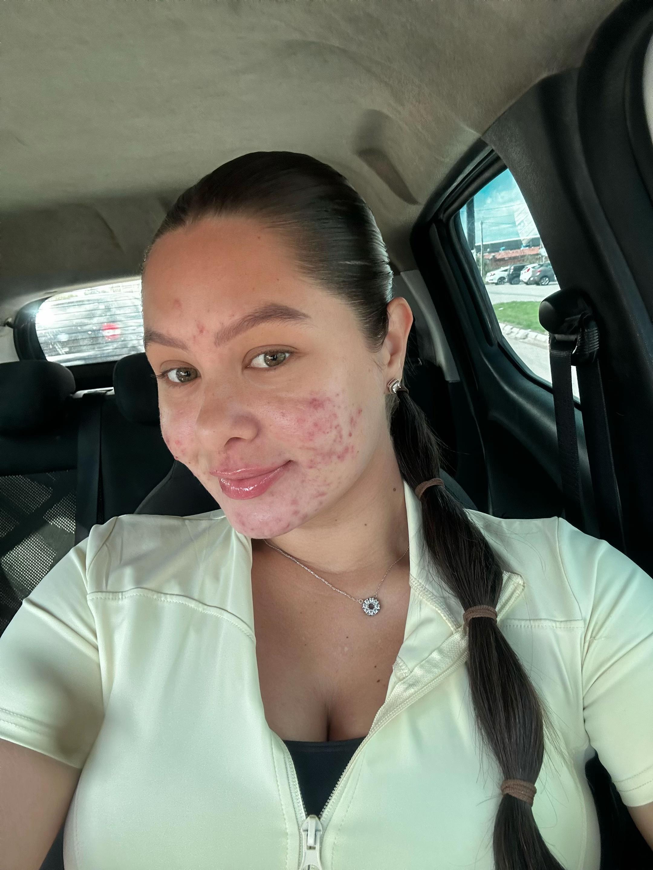 @Francyely 🍓