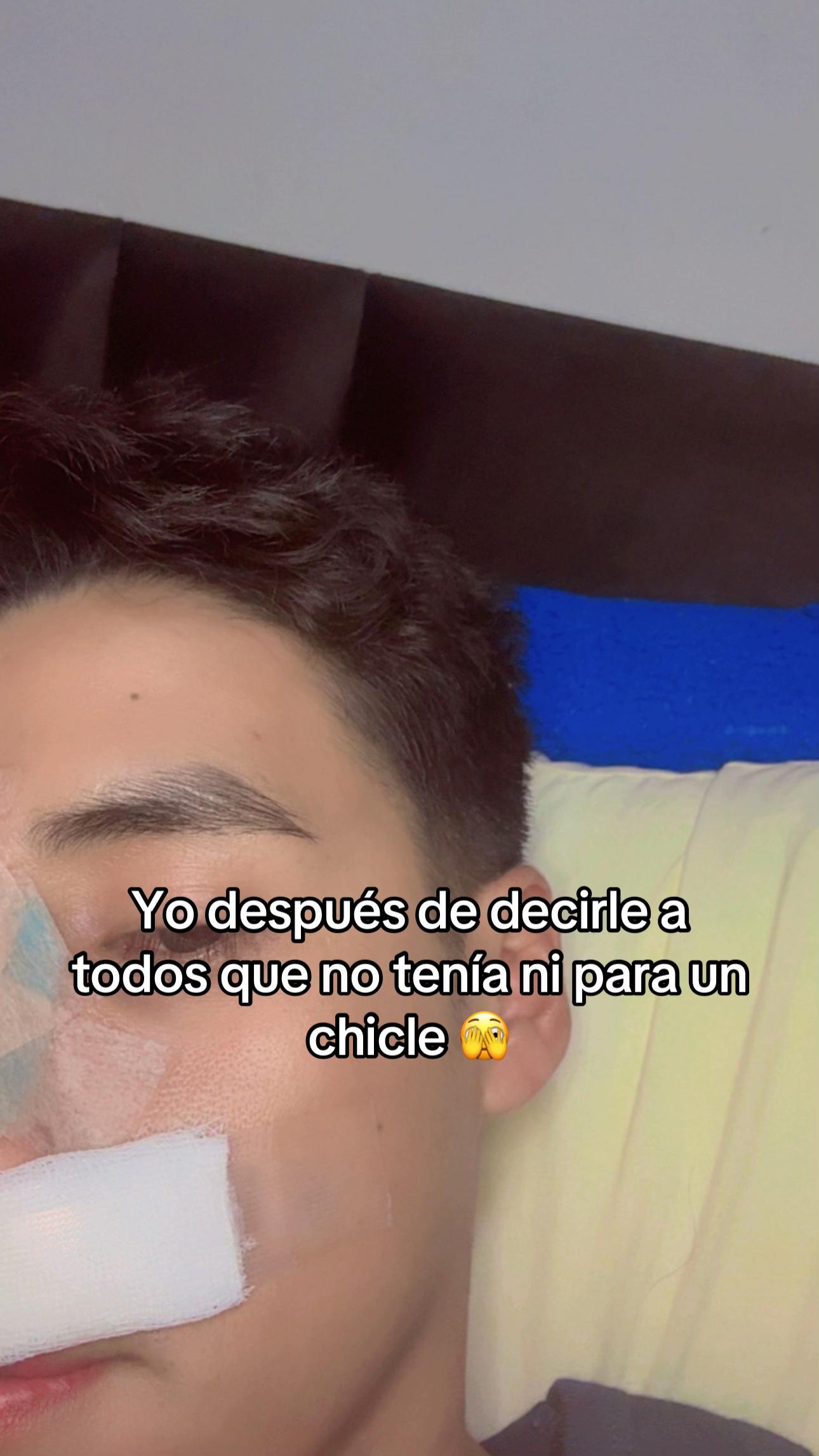 @Albert