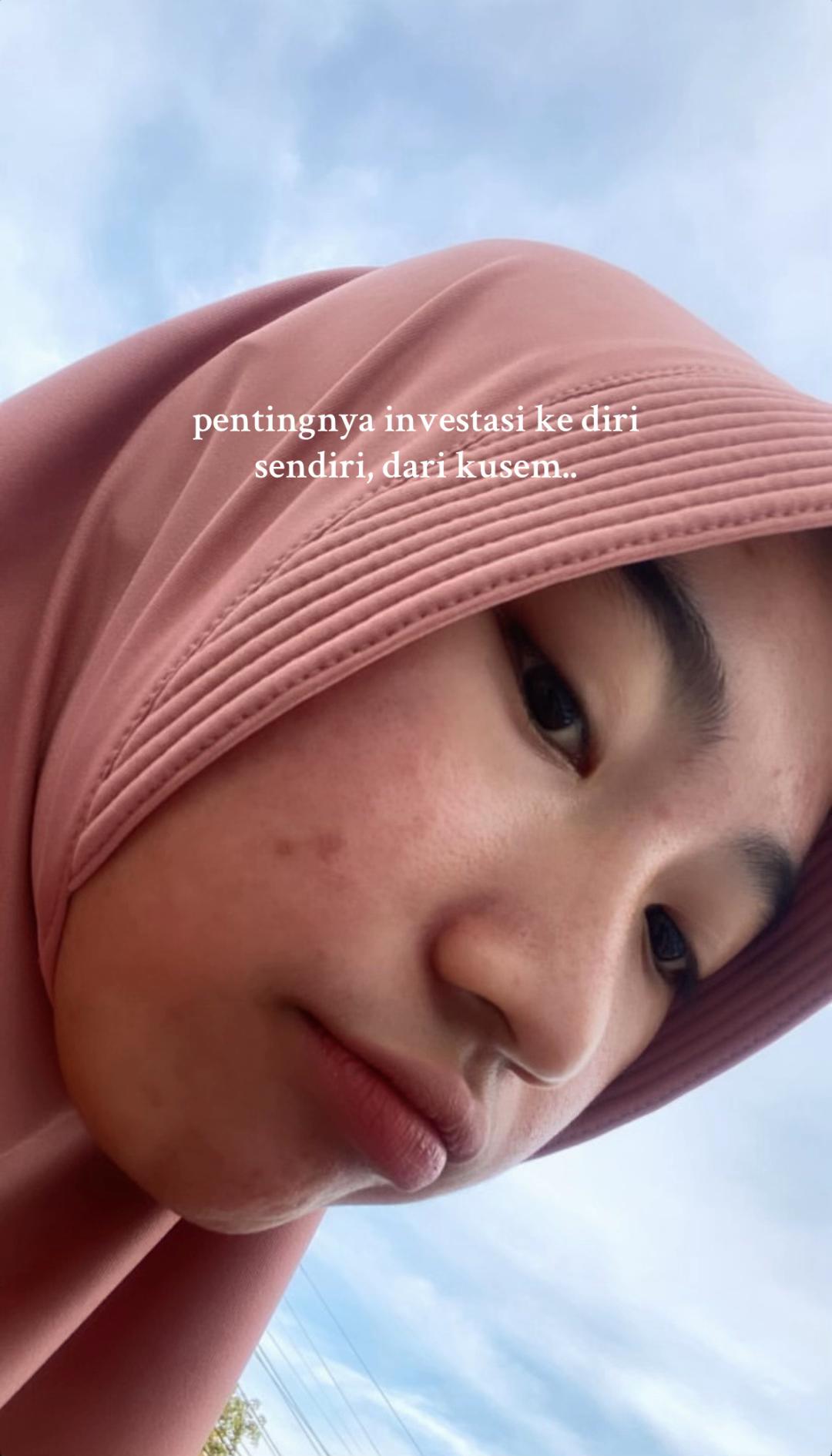 @moonsparkle