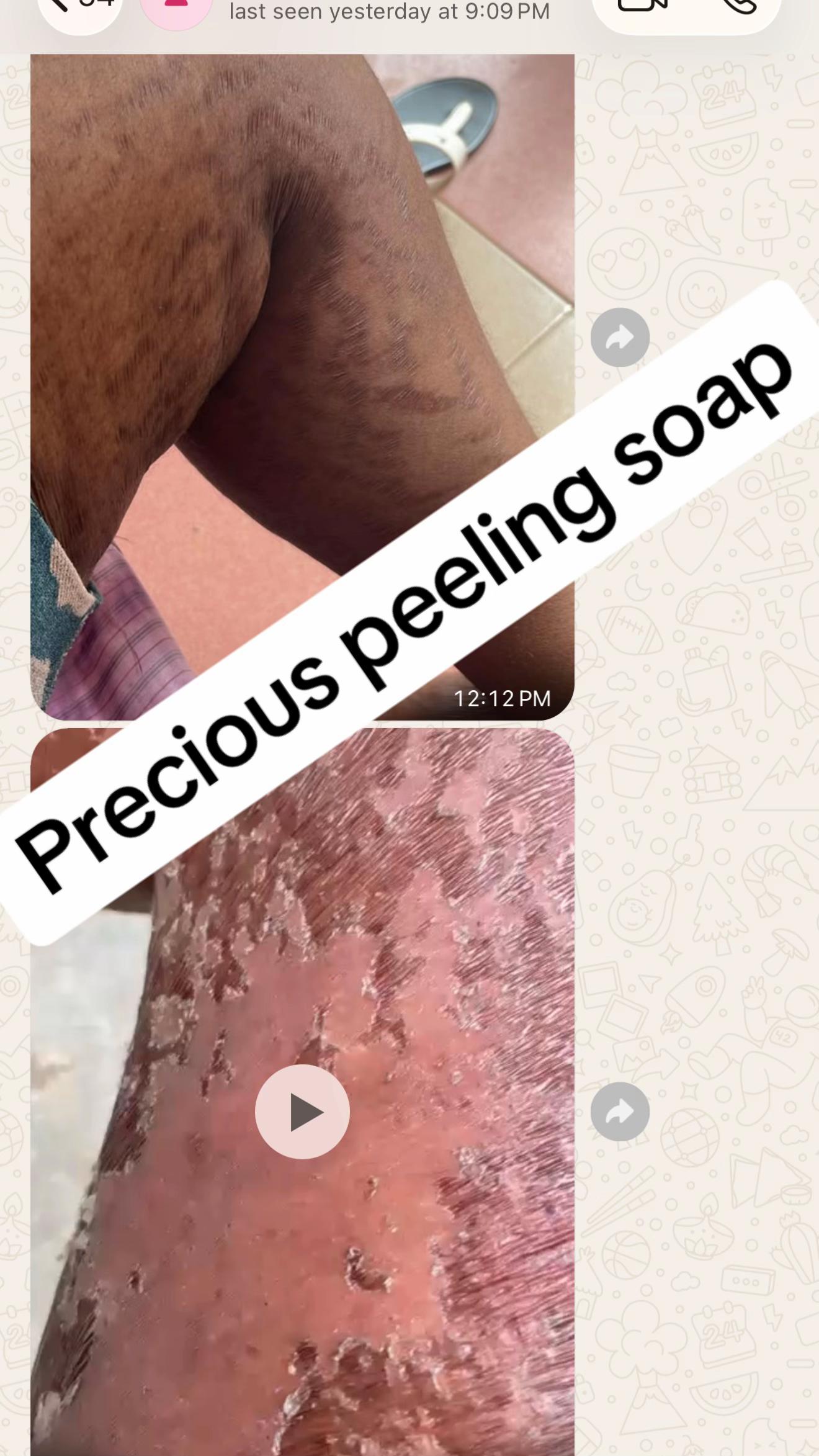 @@ Precious peeling soap