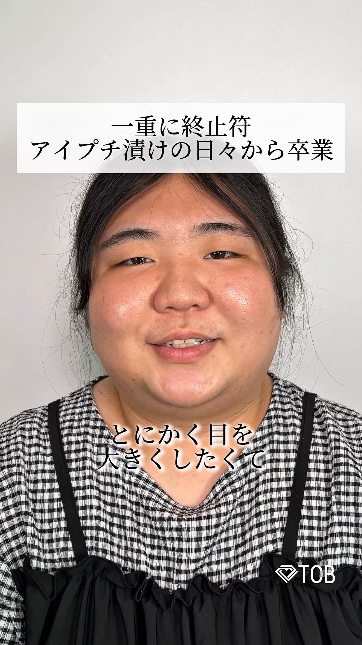 @【二重整形】TCB 新宿東口院ゆいこ先生/東京