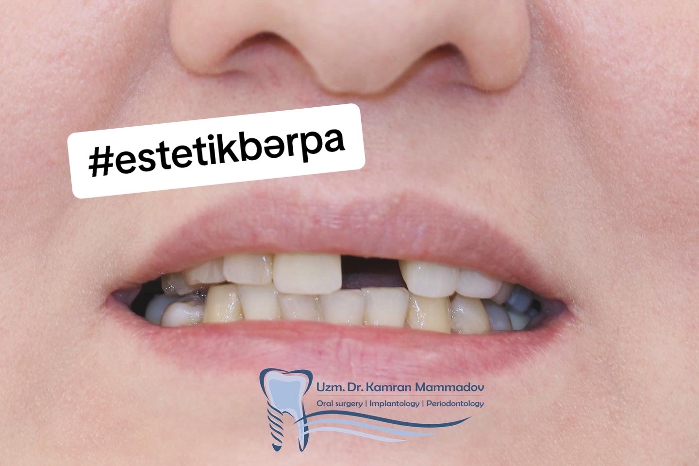 @dr.kamranmammadov