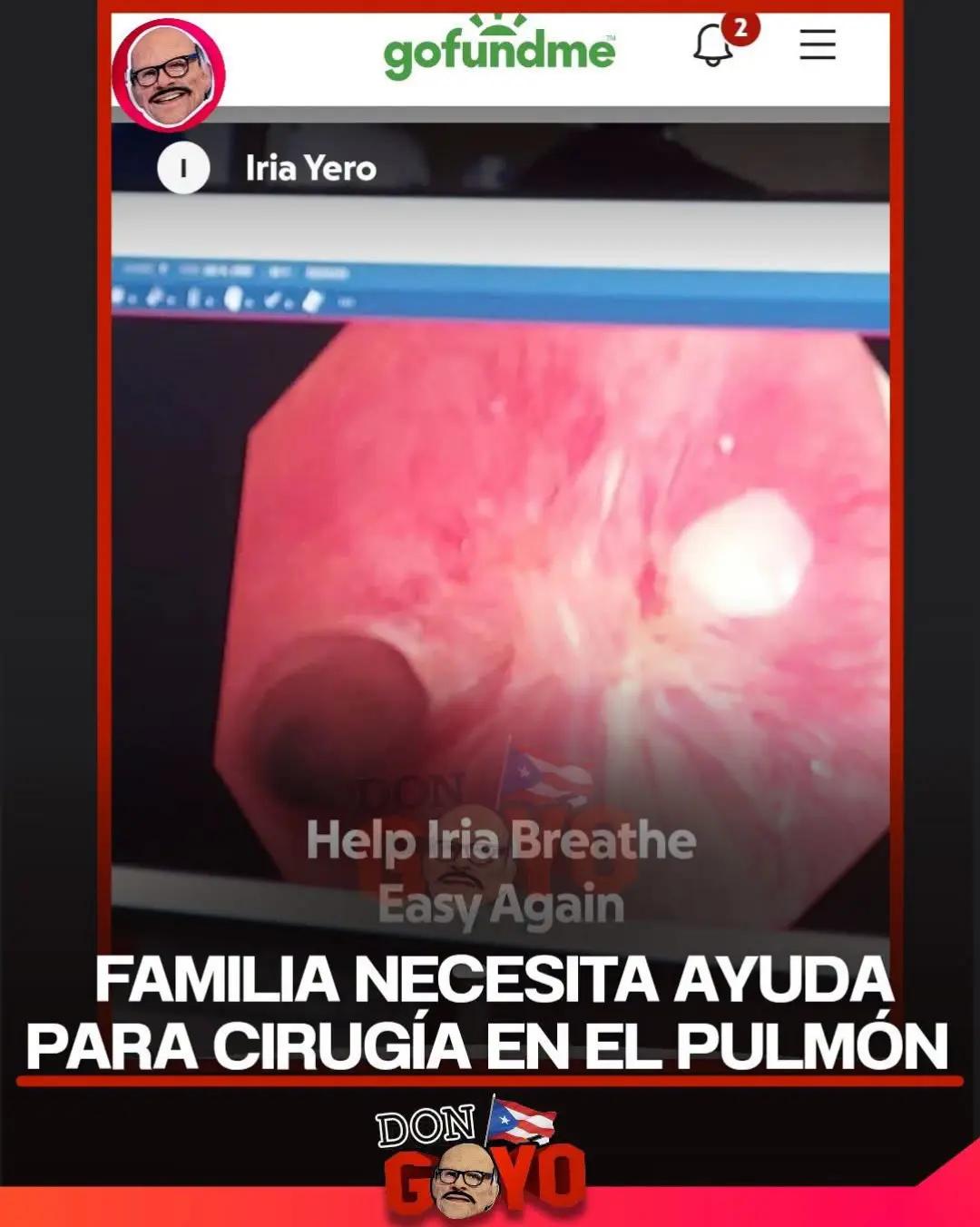@DonGoyoTV