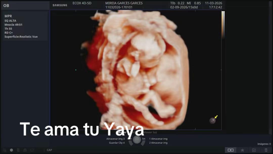 @Israel y piki
