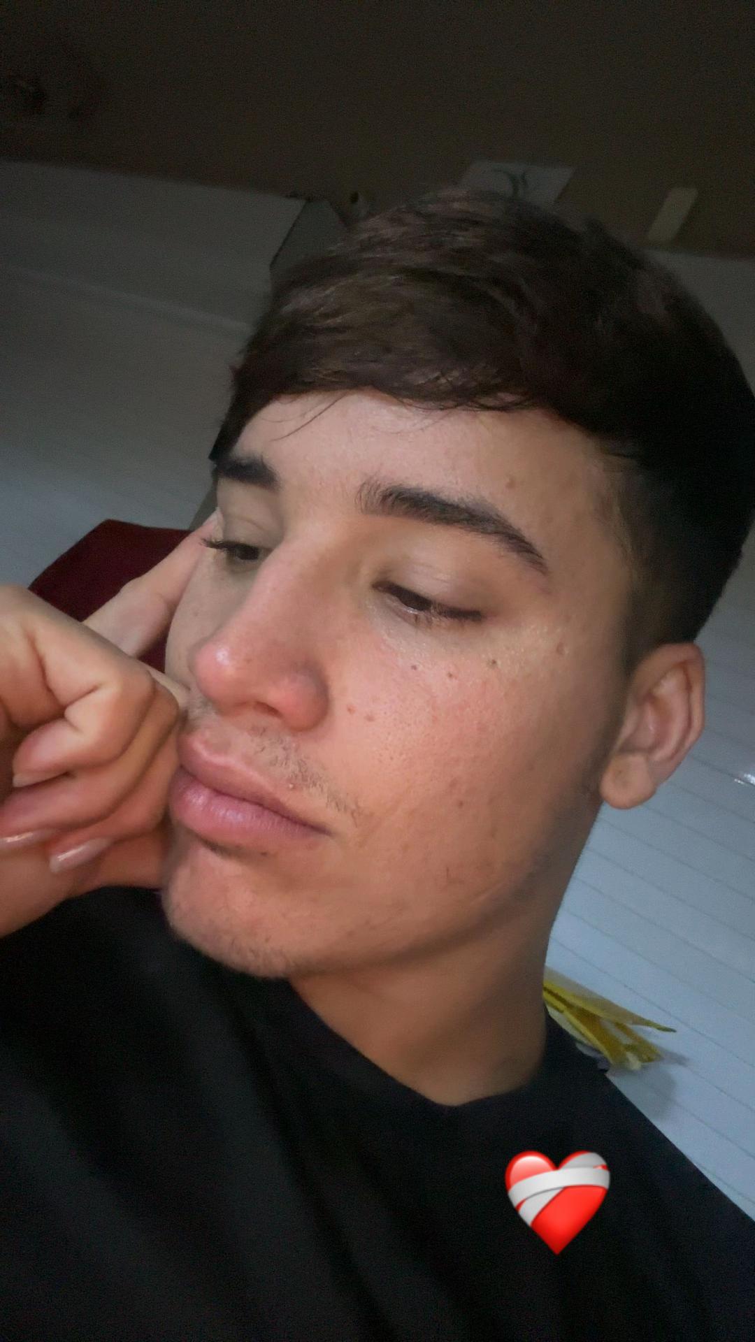 @Franco