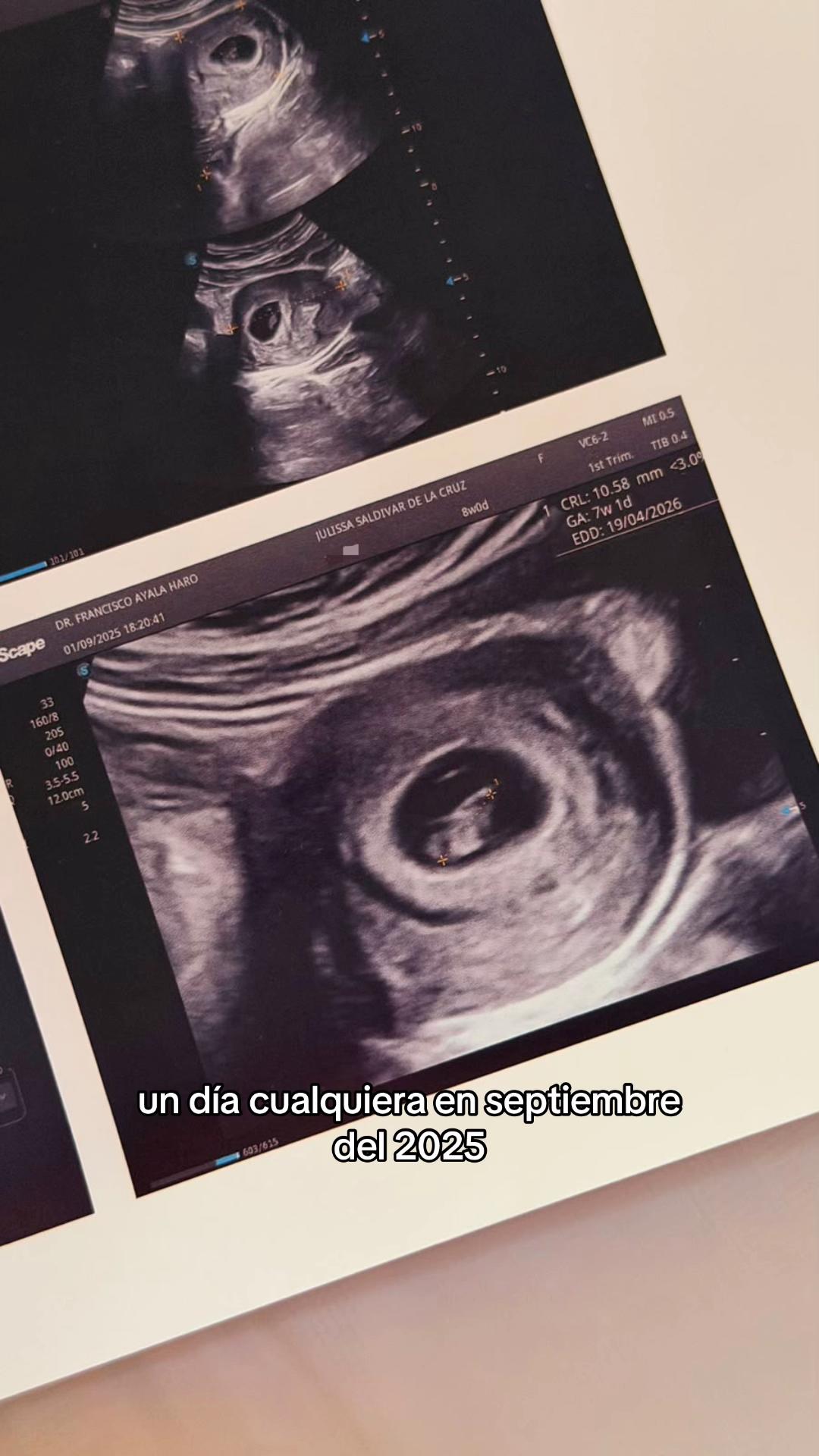 @Jaqueline S