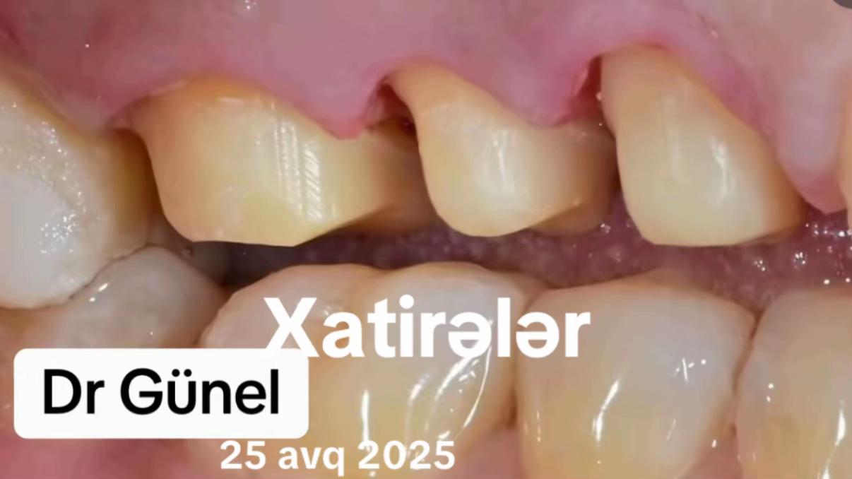 @Dentist_Günel