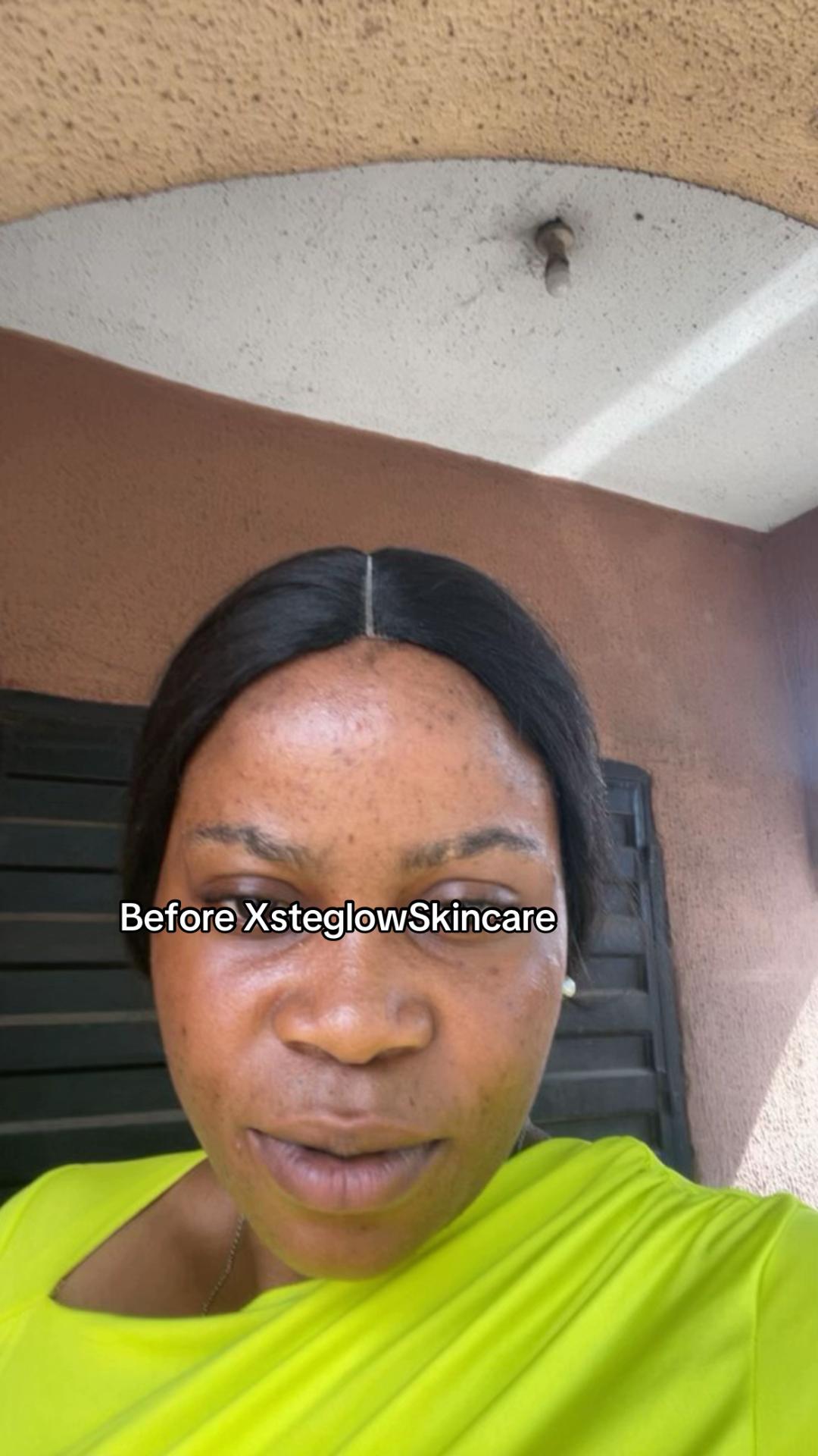 @Xsteglow skincare