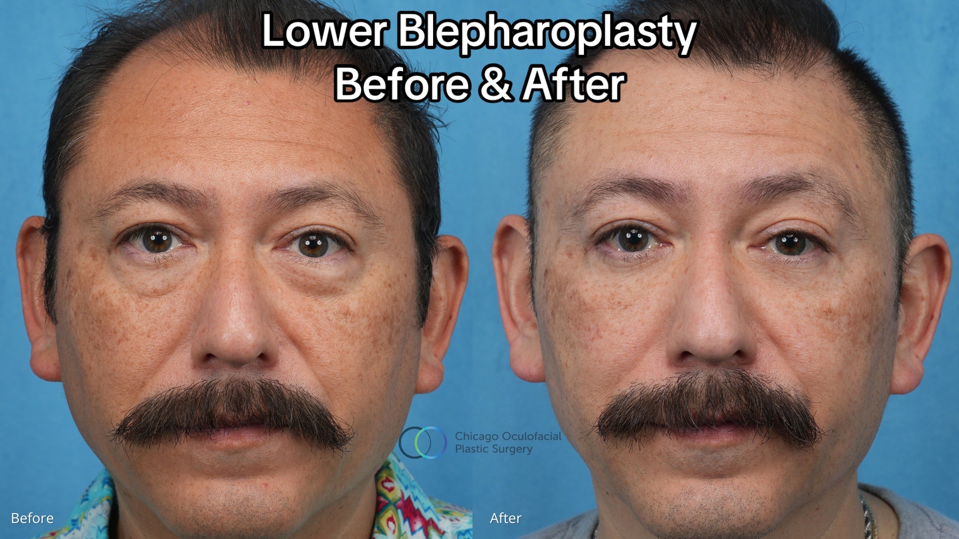 @Paul Phelps, MD