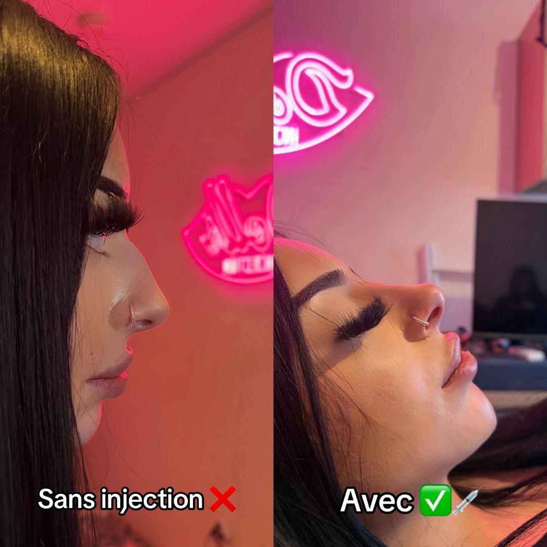 @DOLLS INJECTION 🫦