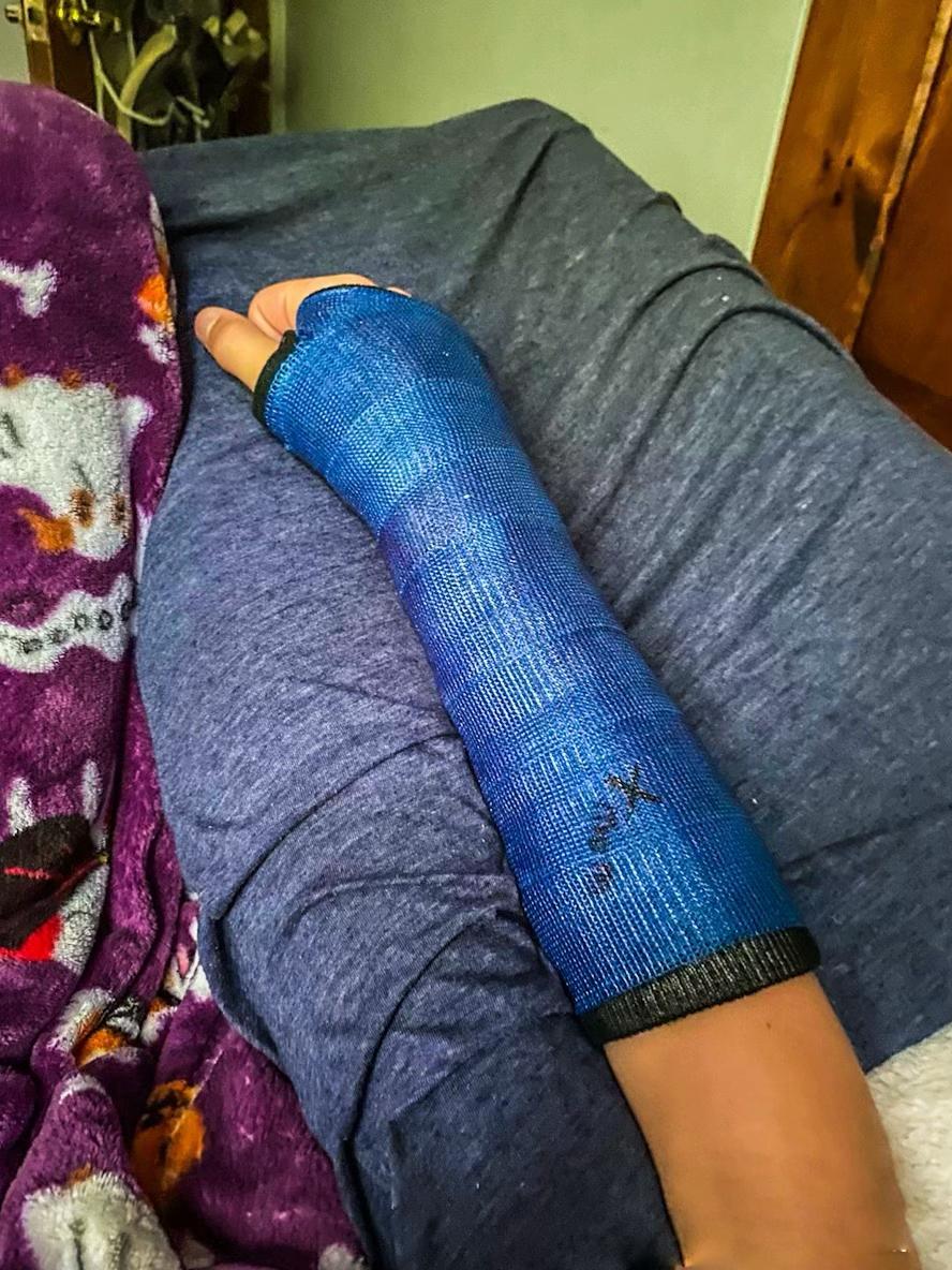 @Gips Fetish