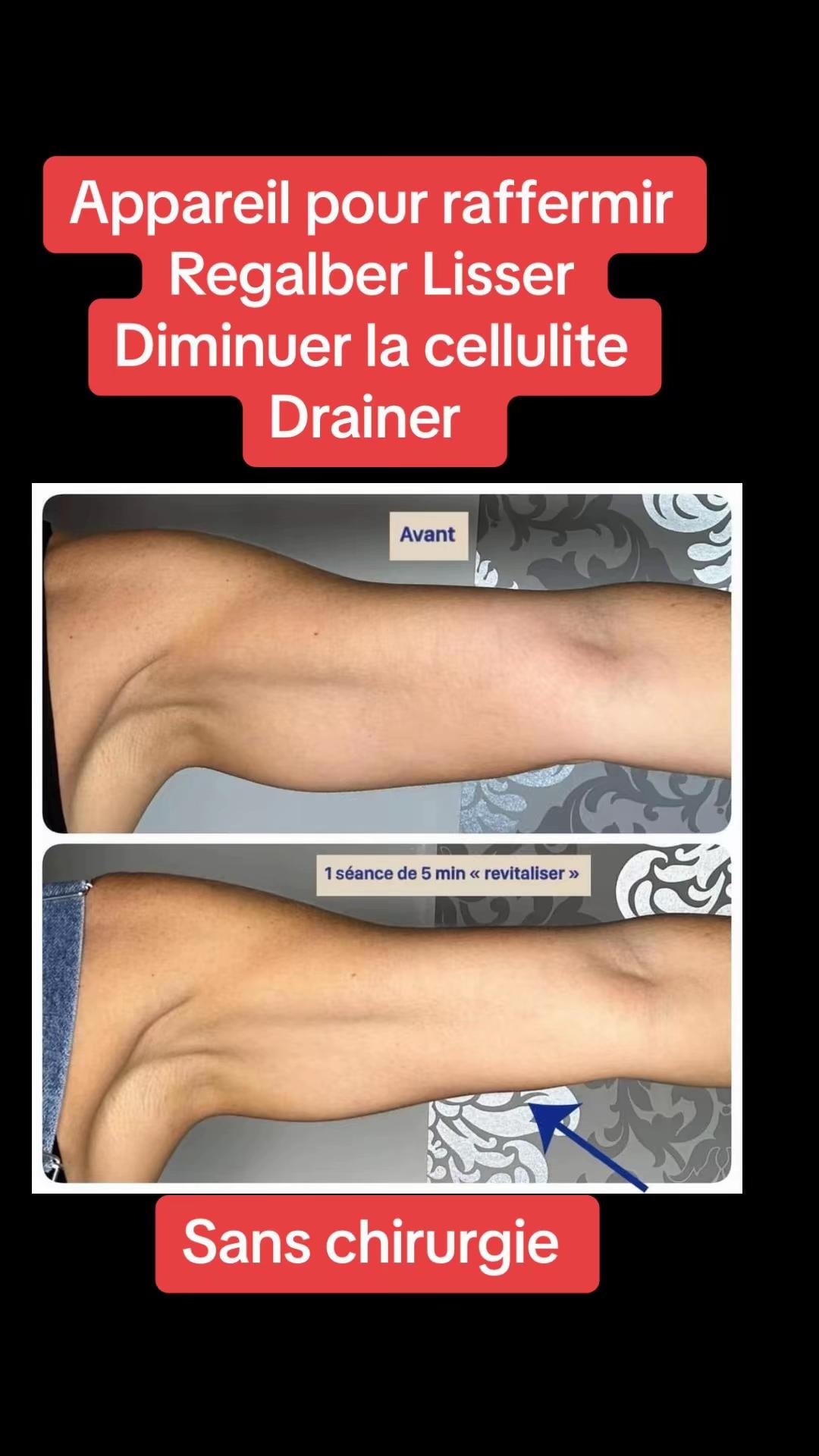 @Nathalie