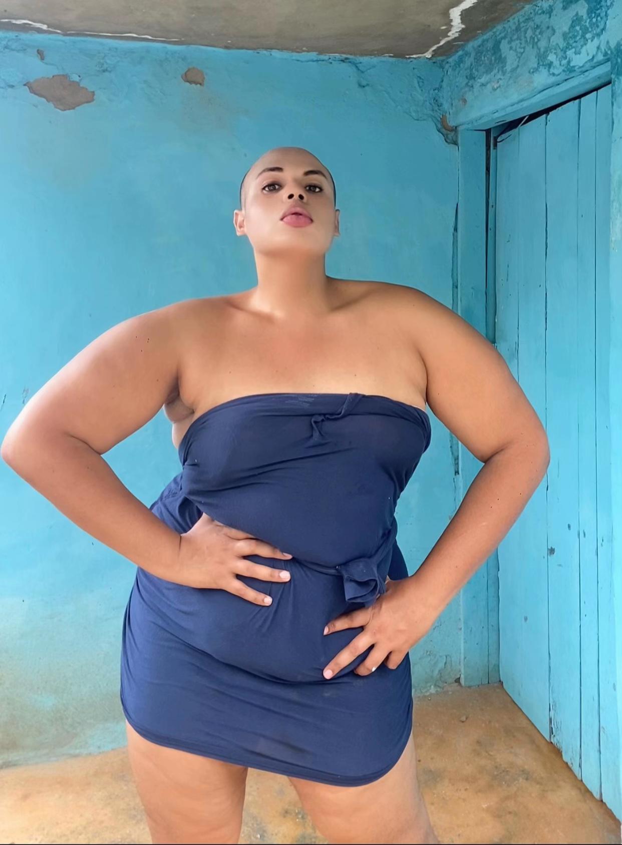 @Aby 🧑🦲