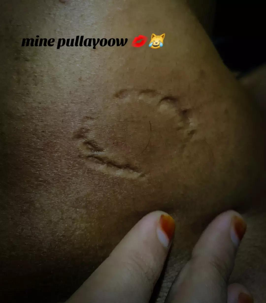@โฅโ๐๐๐๐ ๐๐๐
๐๐๐ ๐๐ผ