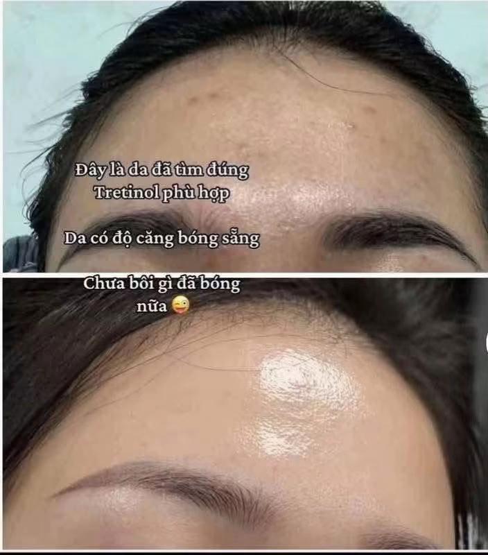 @Hồng Nhung nun