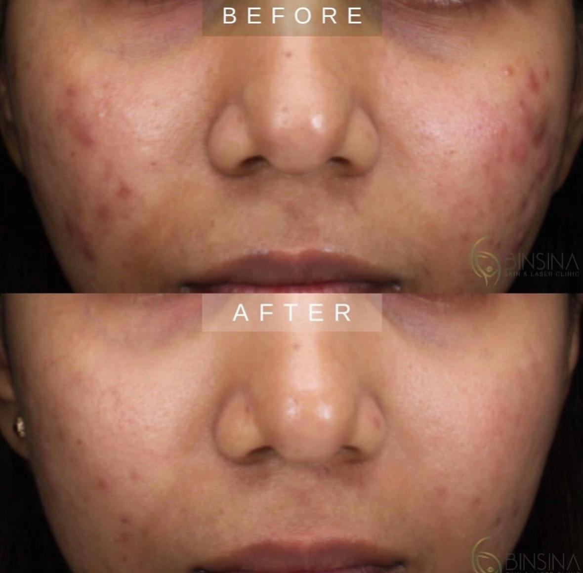 @Binsina Laser & Skin Clinic