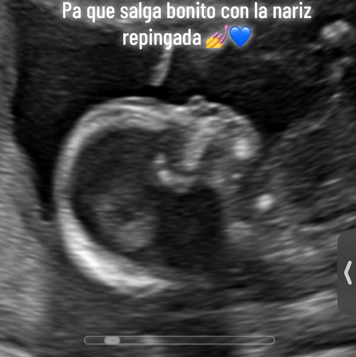 @Nata Sandoval