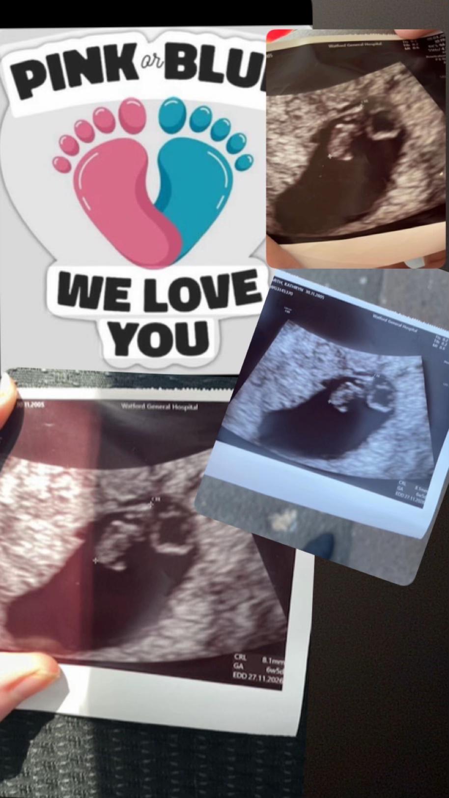 @Kathryn❤️Lenny