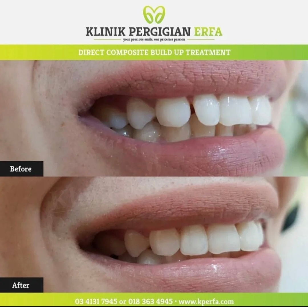 @Klinik Pergigian Erfa
