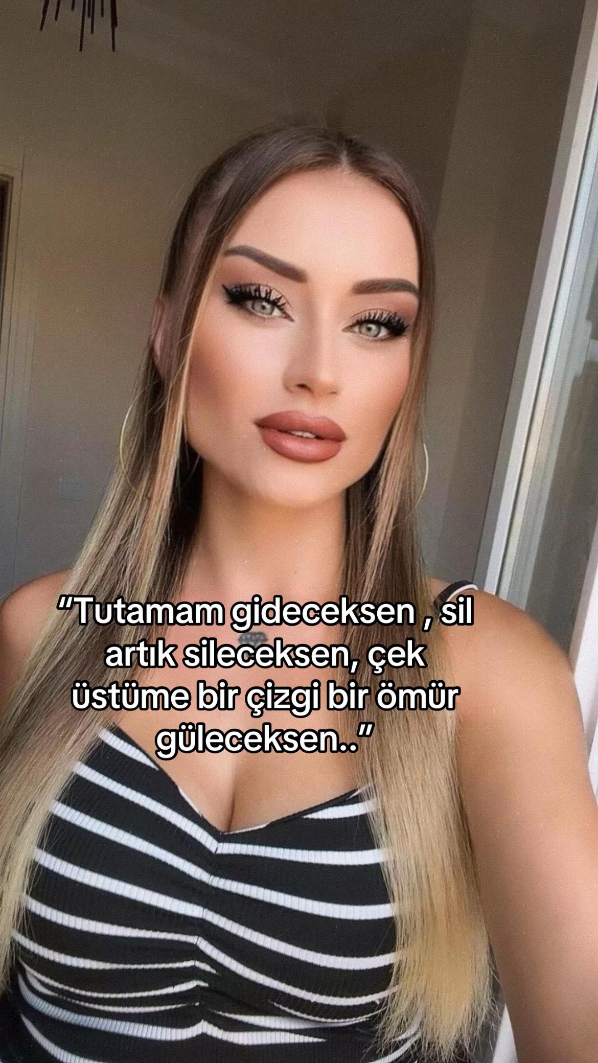 @KİWİ GOZLUU