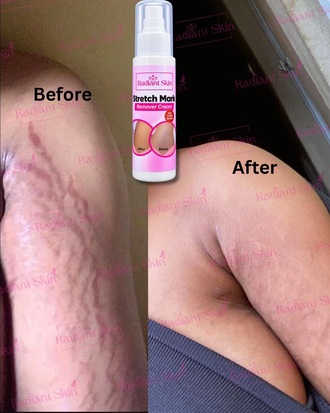 @Radiant skin
