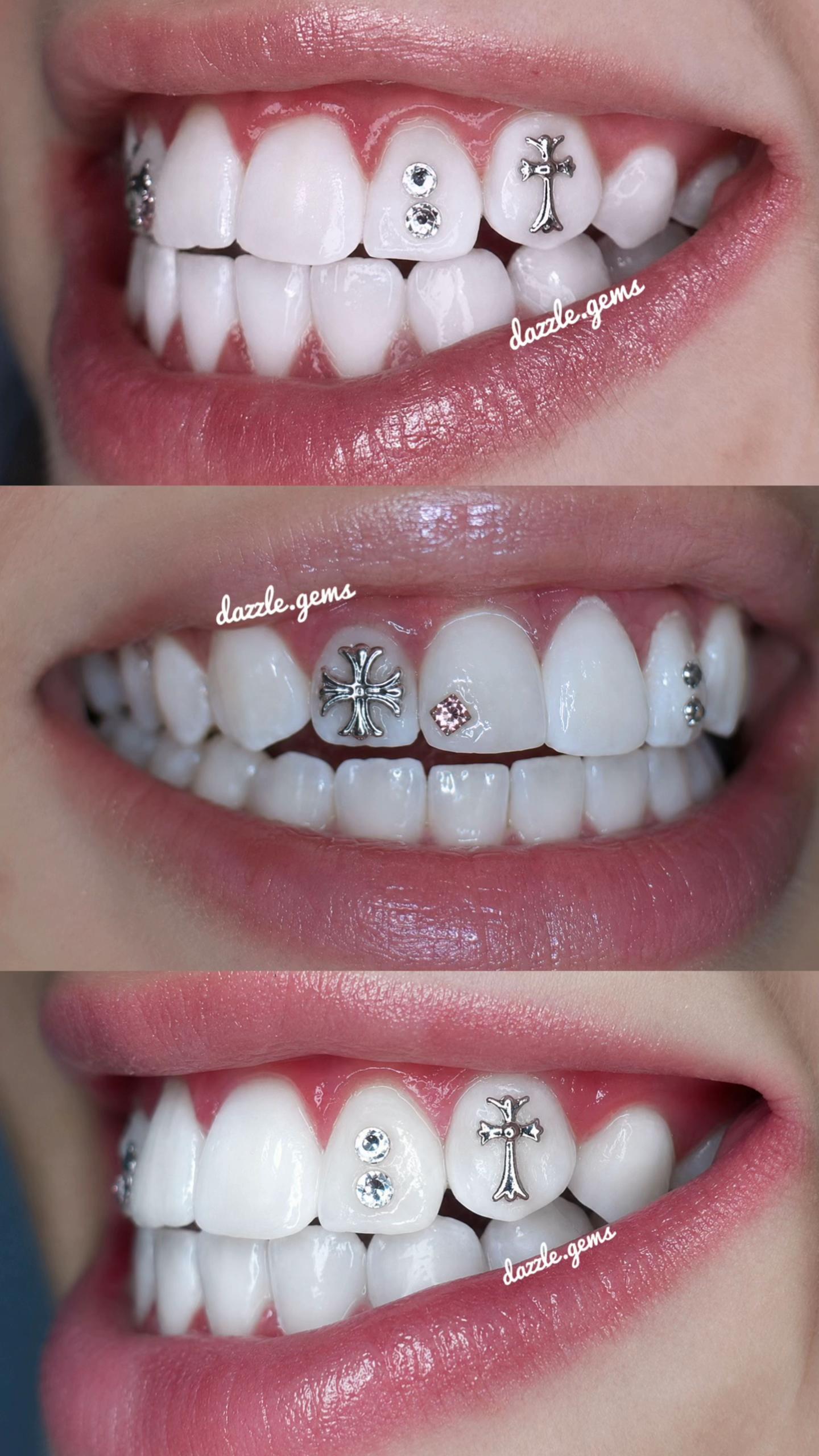 @Piercing - Toothgems
