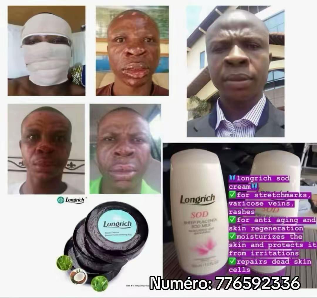 @Longrich_senegal