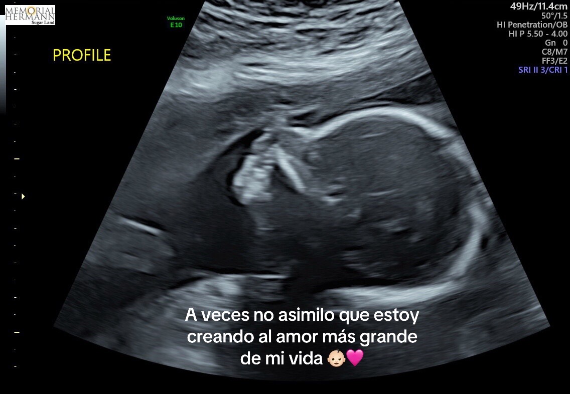 @Julie Gonzalez