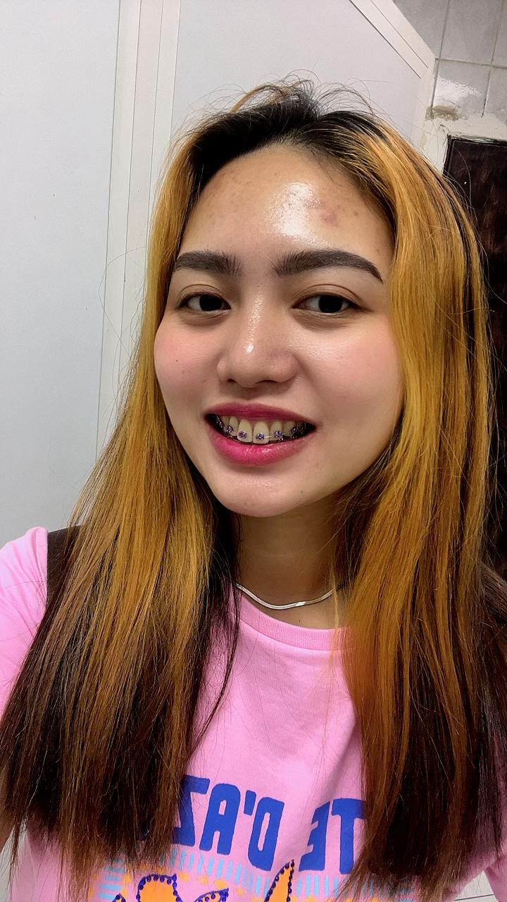 @Nurse Jing ๐ต๐ญ๐ธ๐ฆ