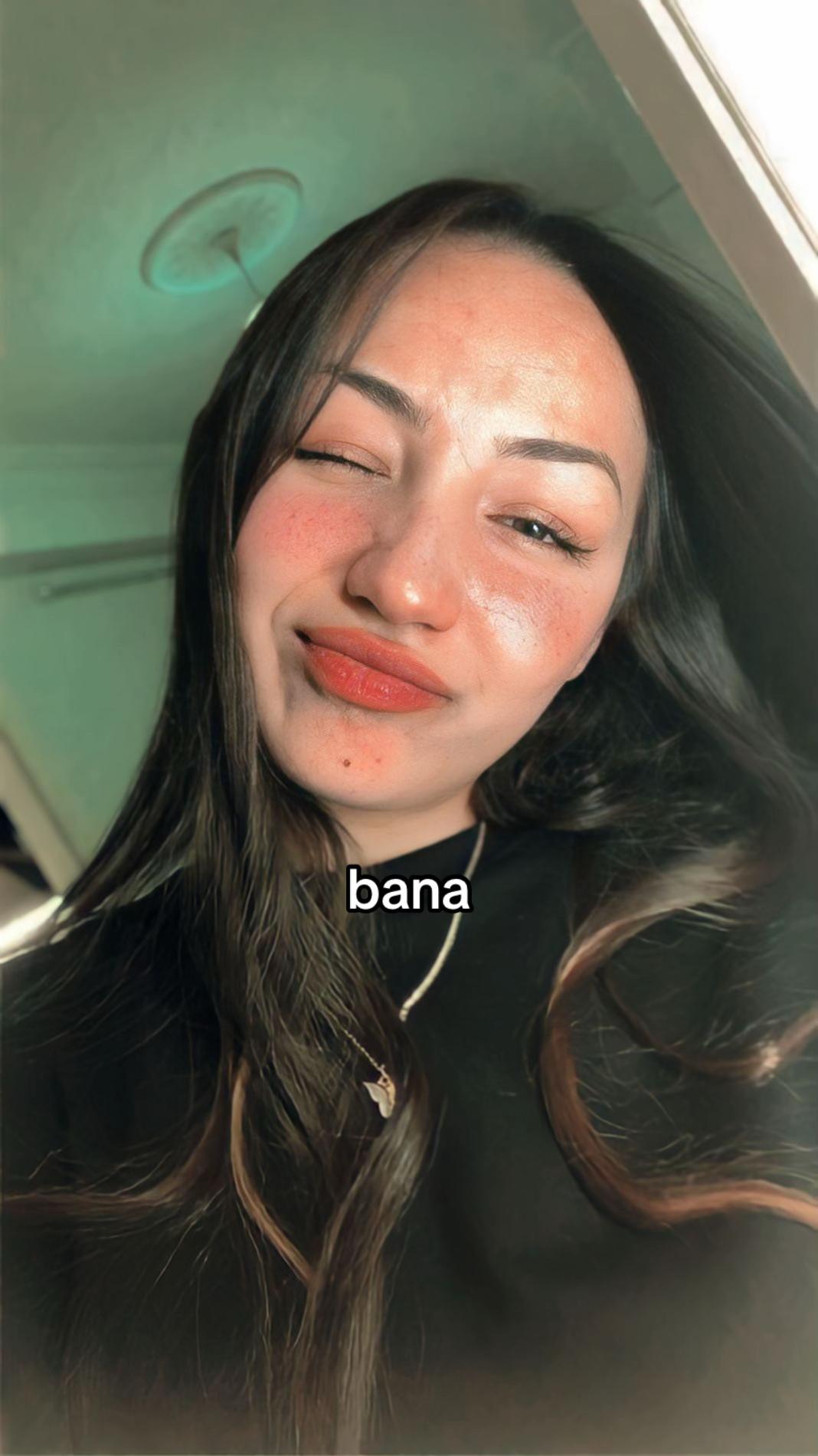 @rg