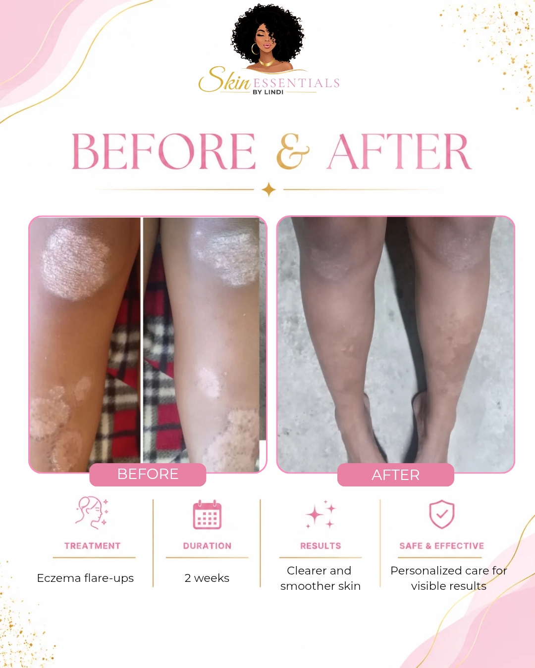 @Skin Essentials | Self Care