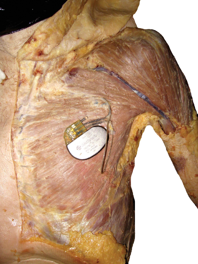 @Pasi&oacute;n por la Anatom&iacute;a