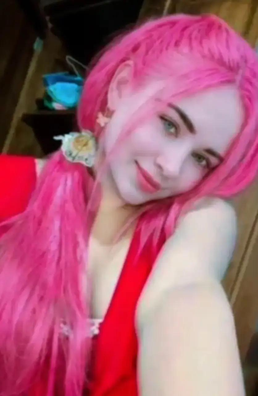 @🧝🤍Albino Girl LK🤍🧝🩵