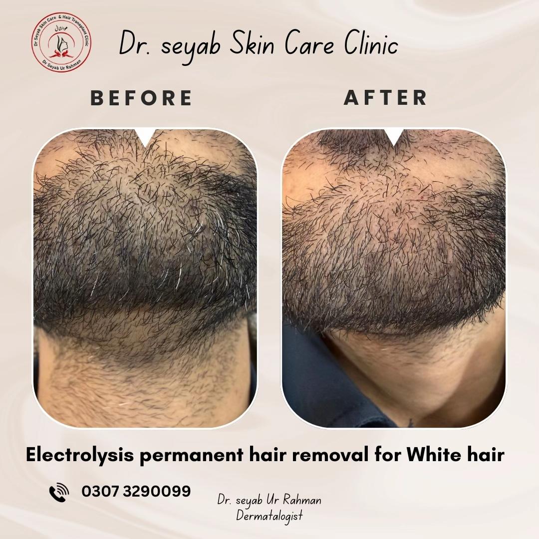 @Dr seyab Dermatologist