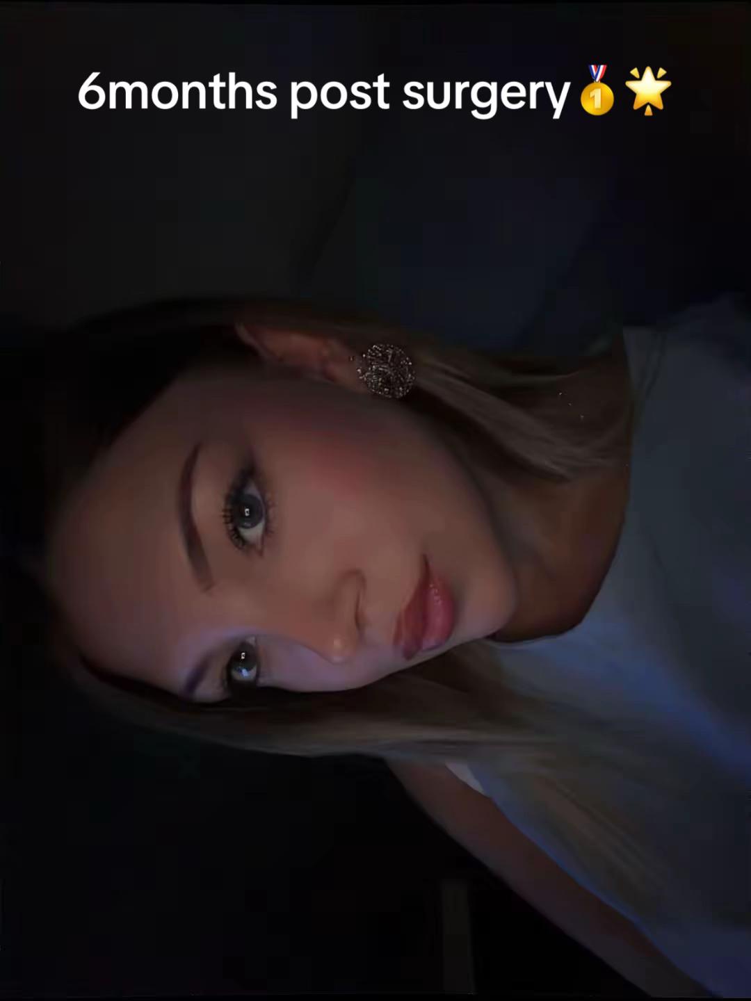 @rinoplasticatirana