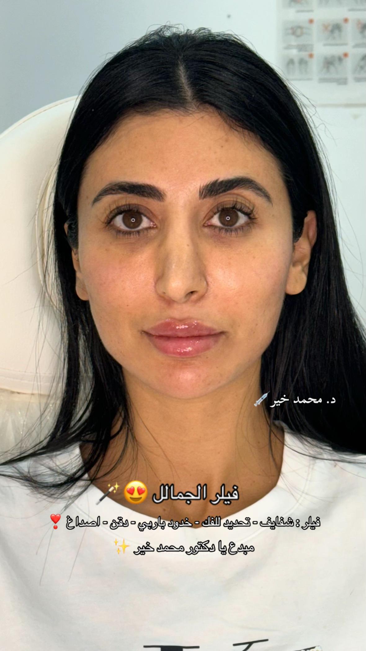 @Dr. Mohamed khier