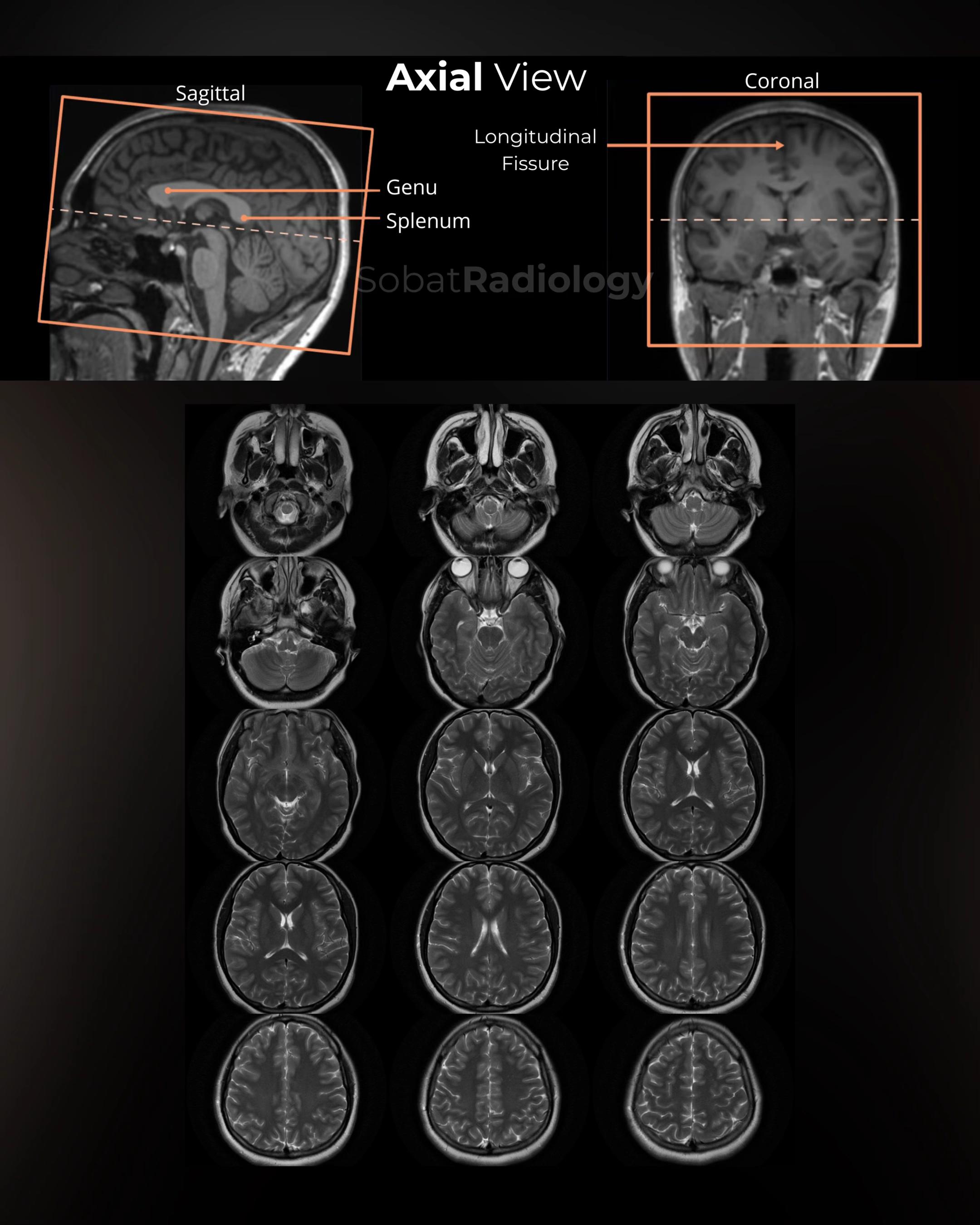 @Sobat Radiology