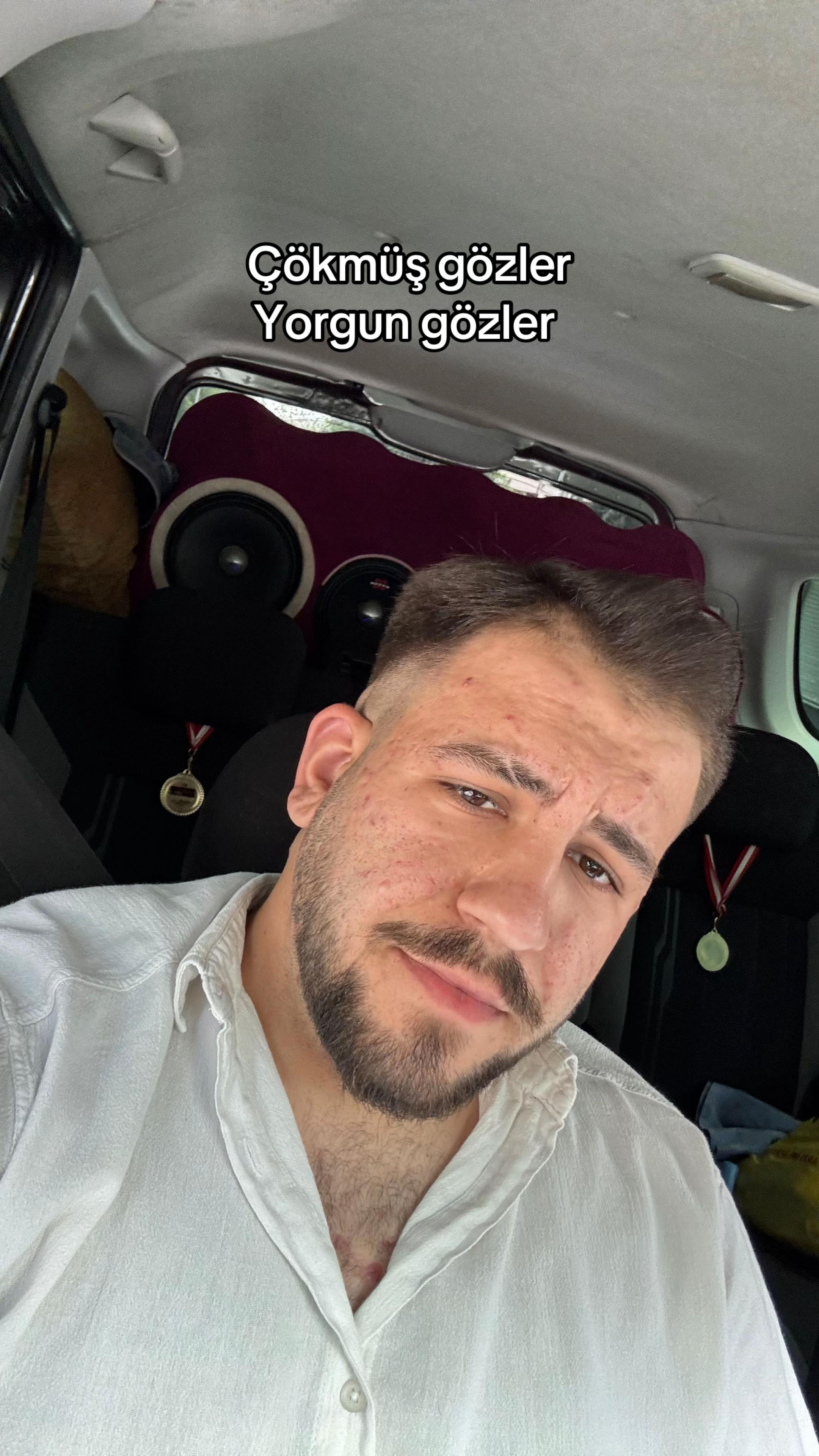 @YİGİTCAN ER