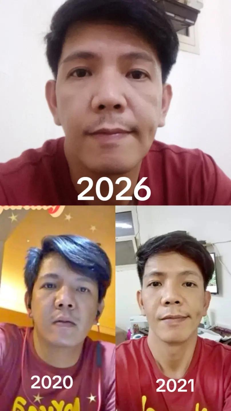 @Peter Lacbayan de Ve