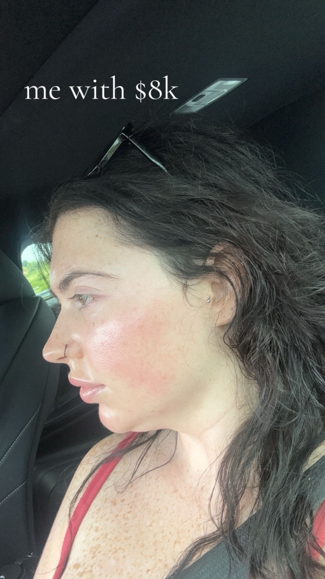 @ABBY OYSTER | NASH SKIN GURU