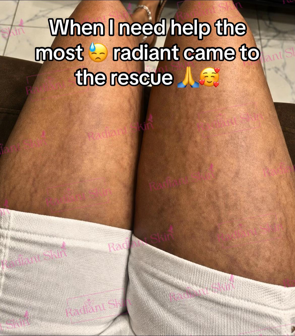 @Radiant skin