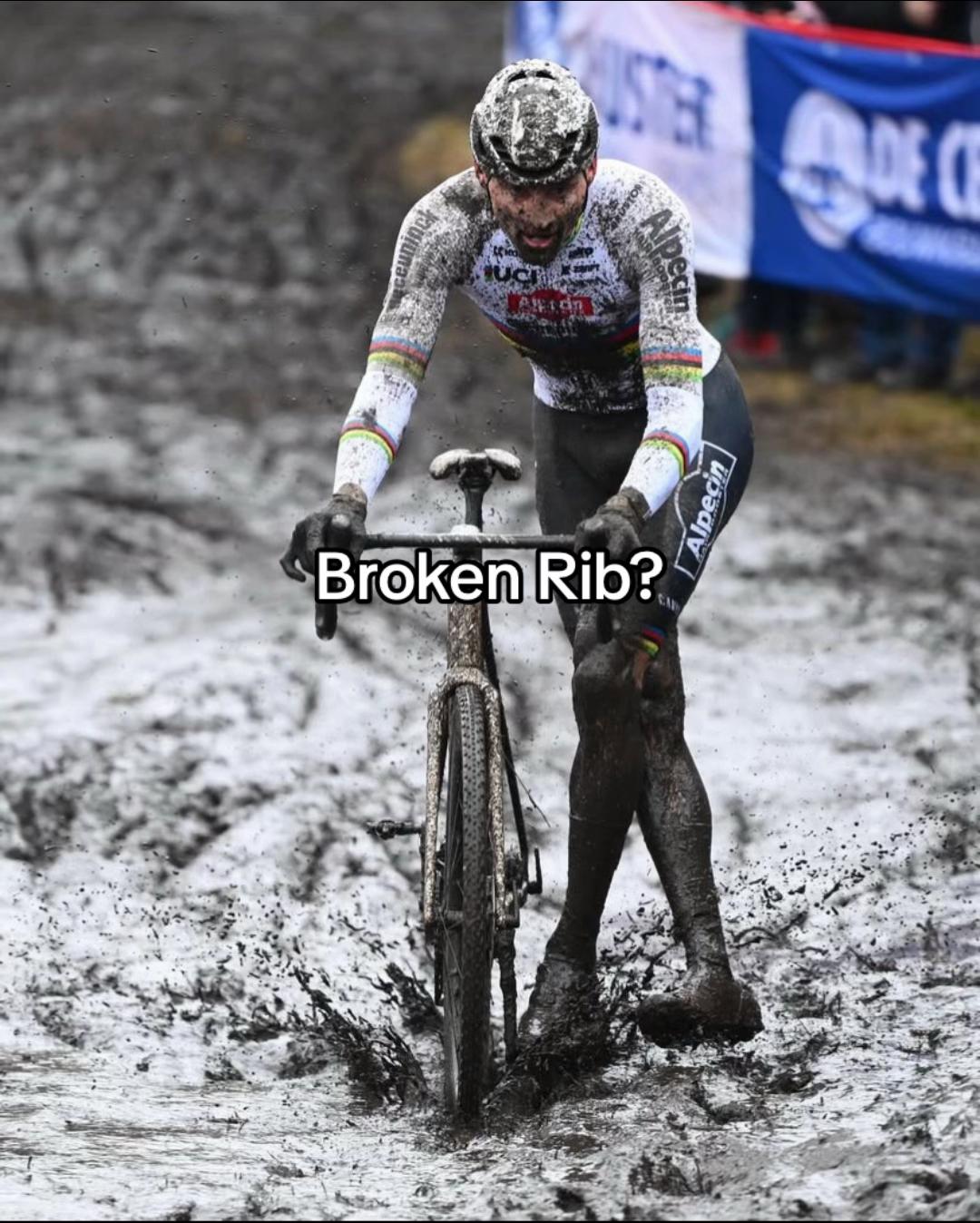 @Cycling_edits