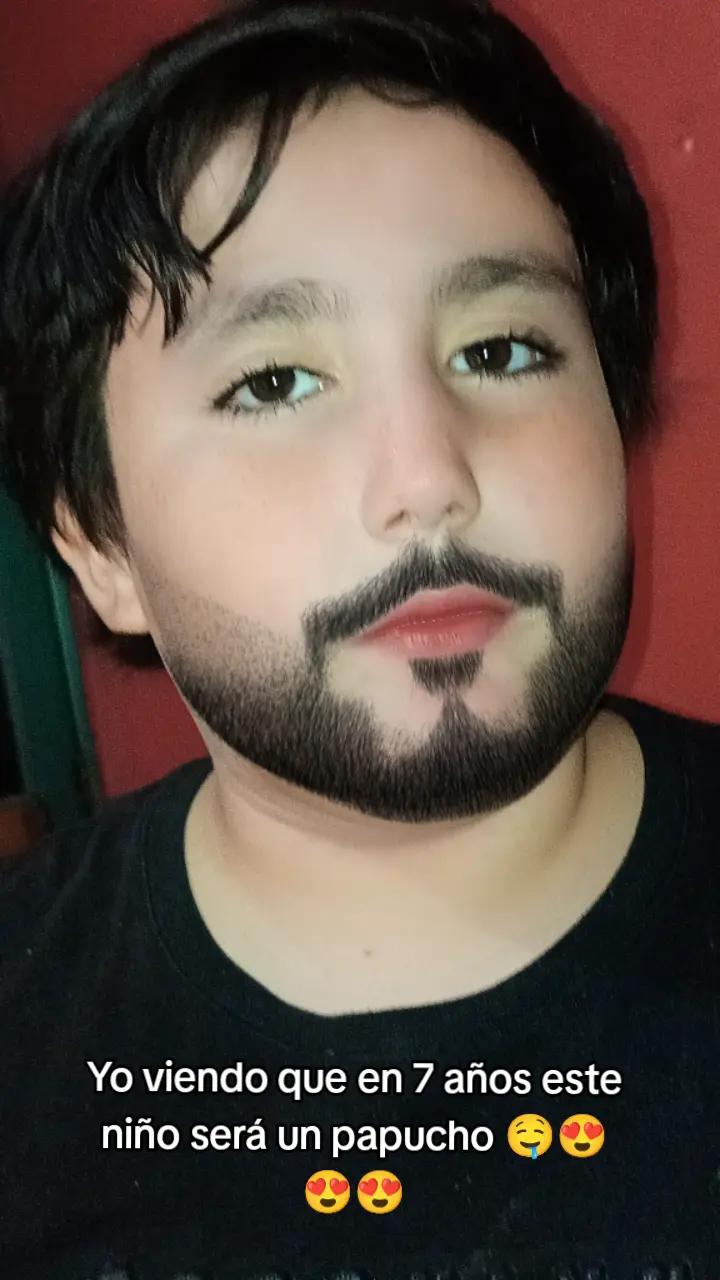 @Gitzel Burgos