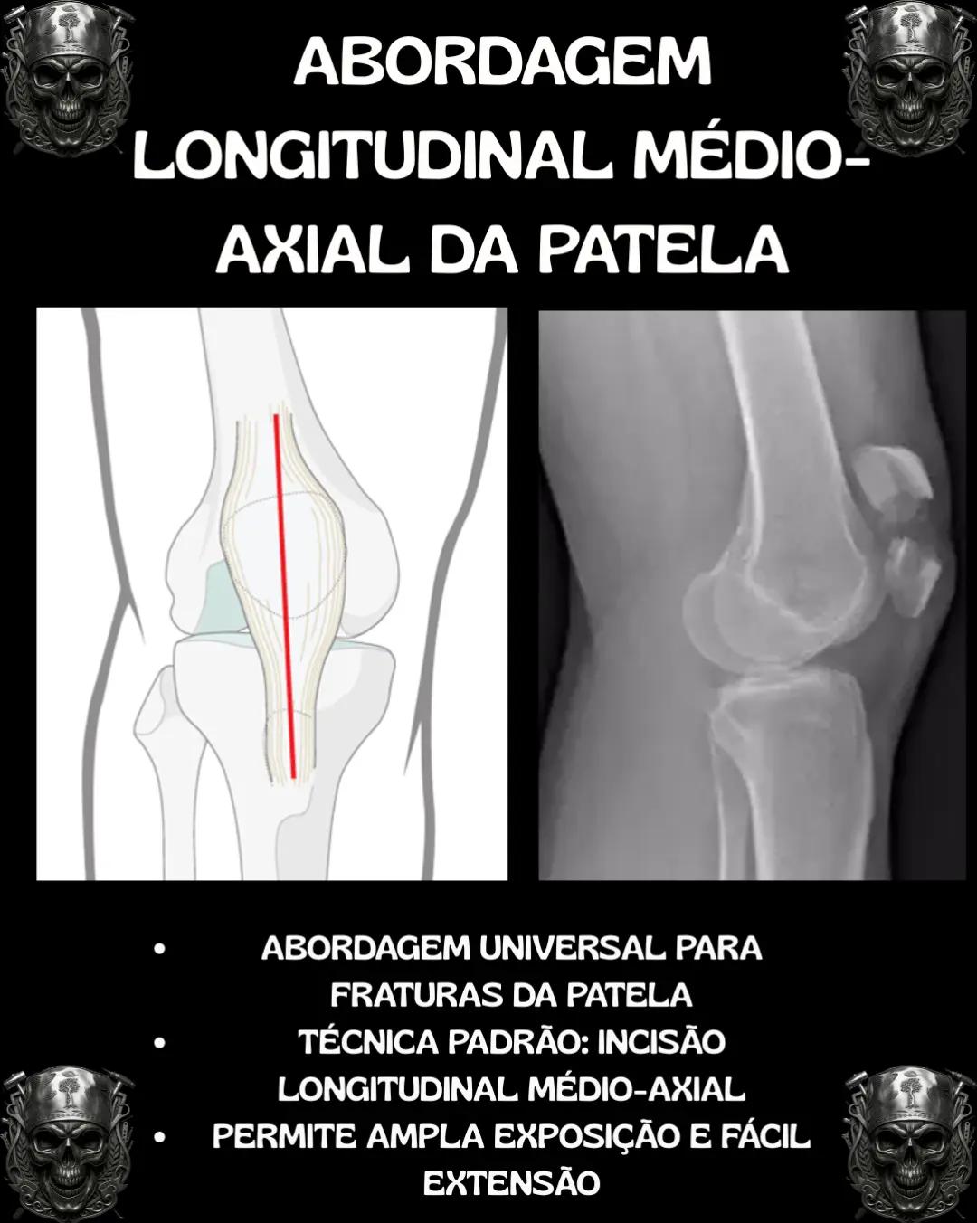 @Traumatologia Maluca