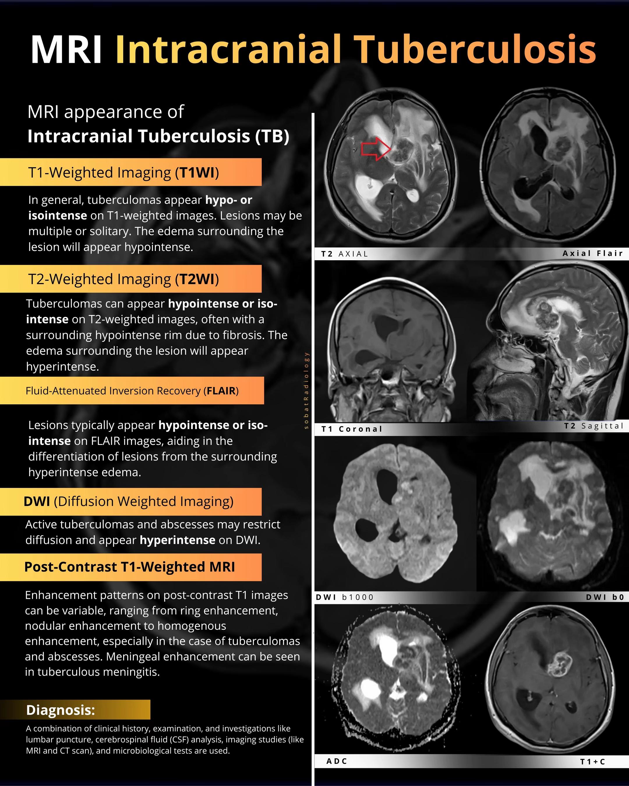 @Sobat Radiology