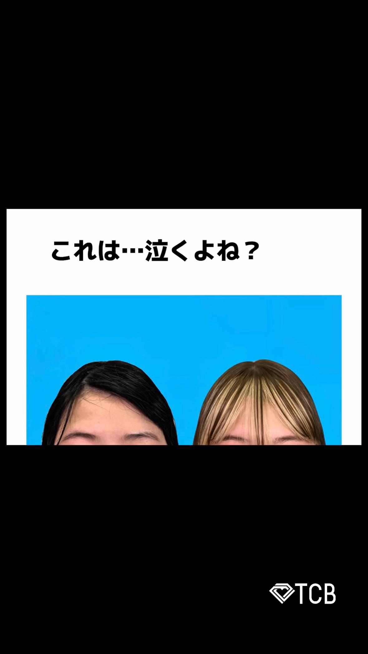 @【二重整形】TCB 新宿東口院ゆいこ先生/東京