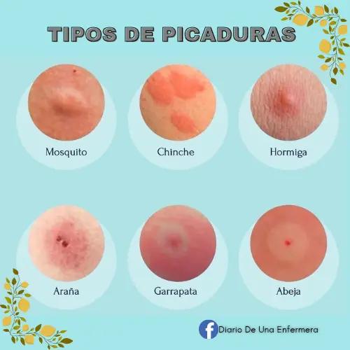 @Diario De Una Enfermera