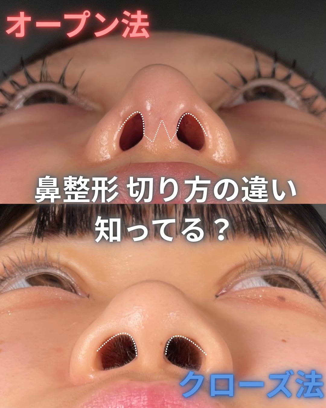 @鼻整形R Beauty CLINIC 副院長👨&zwj;⚕️吉田慧