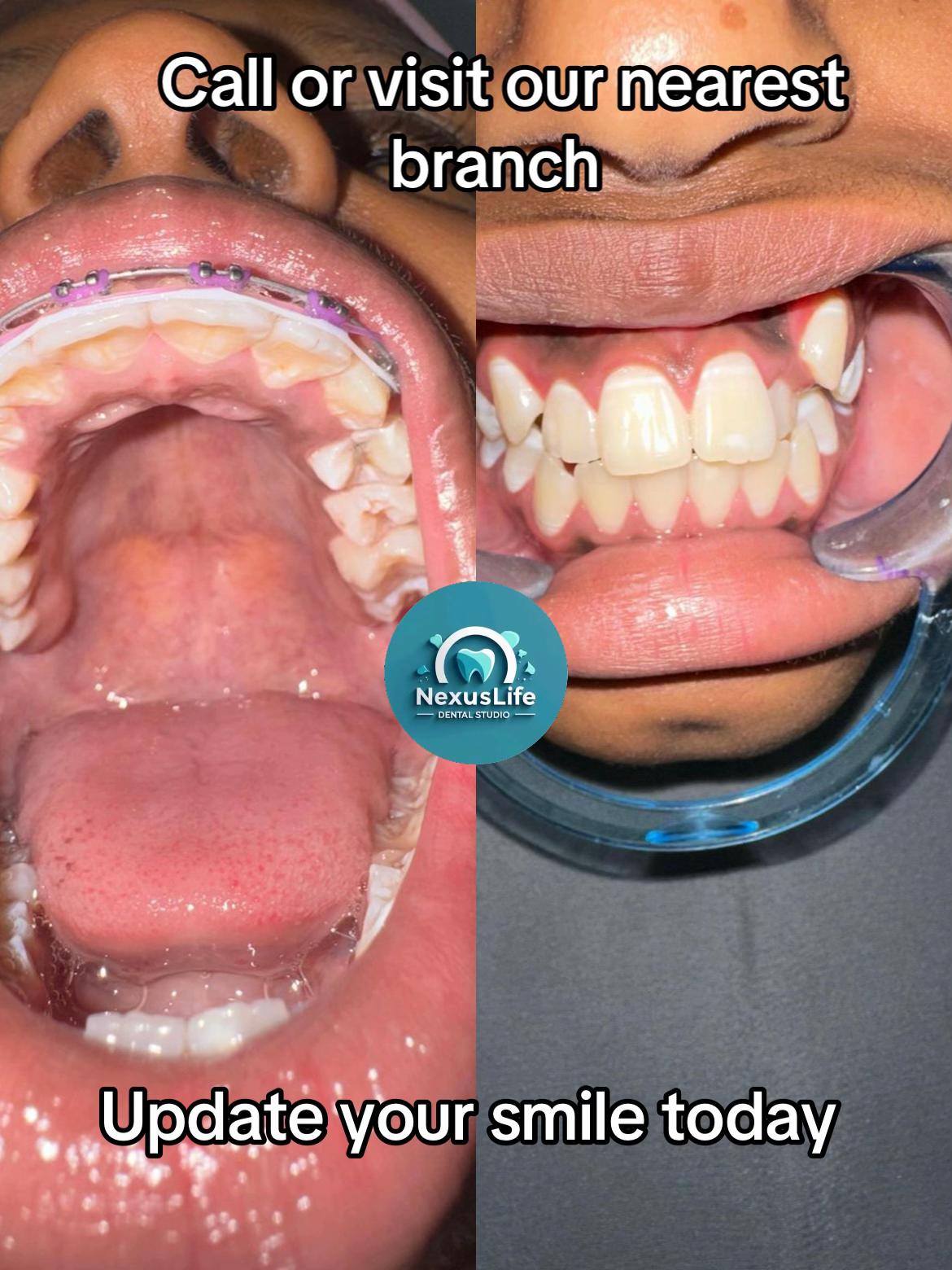 @NEXUSLIFE DENTAL CLINIC🦷